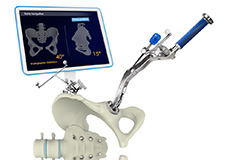 Computer Navigated Total Hip Replacement