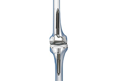 Correction of Failed Knee Replacement