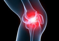 Knee Pain